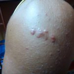 I Fought a Dirty Cop for my Life in Tanzania