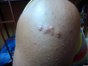 I Fought a Dirty Cop for my Life in Tanzania